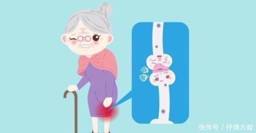 有用|藏在身边的“养骨食材”,比钙片有用,早起吃一些,骨骼稳当当