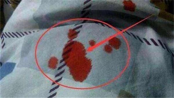 床单沾上血渍不用愁,教你简单方法,新旧血渍都能洗得干干净净