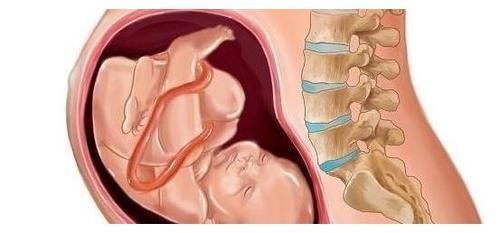 化学物质|怀孕时,孕妇在这件事上越懒,可能宝宝越健康,早看早了解