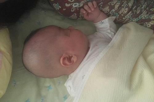 枕头|孩子刚出生就给枕枕头，导致头型太难看，医生询问原因后无奈摇头