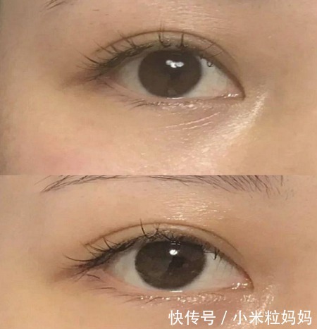 热门高口碑眼霜大公开，称得上是眼霜界的“爱马仕”，孕妇也可用