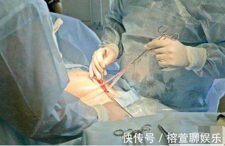 羊水|剖腹产仅划一刀就了事太天真!先看看用的器具,就知道女人多牛