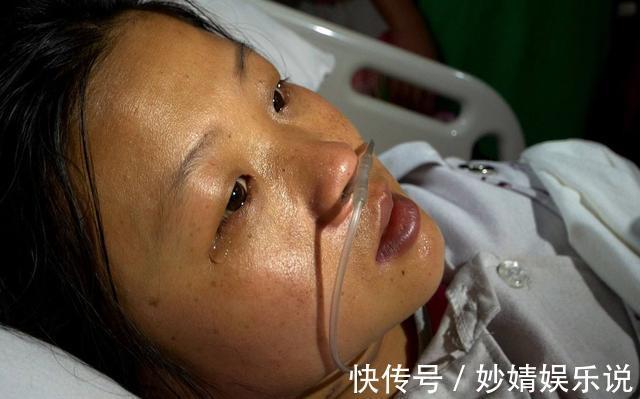 脸色|为何越来越多人得尿毒症?当身上3处亮起红灯,要留神