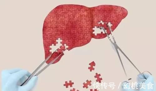 醒来|总是半夜三更醒来，别简单以为是失眠，或是3种疾病来袭，别大意