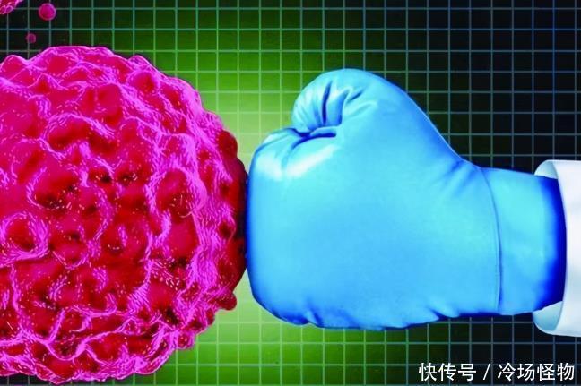 肝癌患者|什么是“带瘤生存”这名15公分巨大型肝癌患者是如何实现的