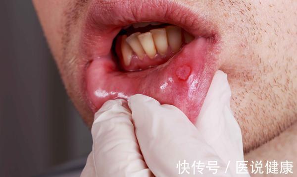 上火|上厕所时,尿液发黄且异味重?或与这5个因素有关,及时检查