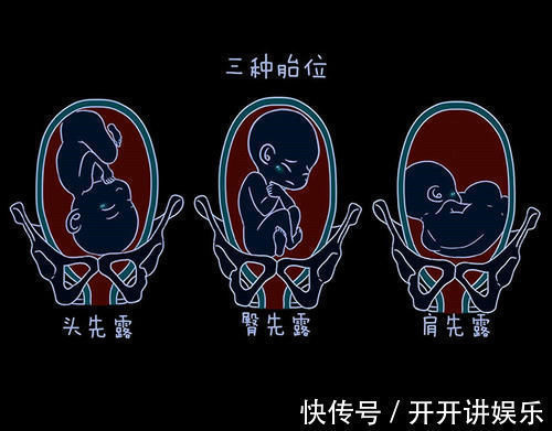 产检|怀孕28周去产检,这3个问题,就算医生不提及,孕妇也要记得问