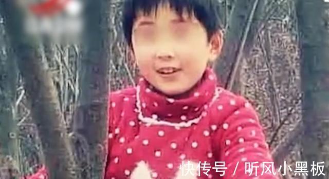 表皮|故事山东8岁女孩患怪病,为活命全身移植猪皮,监控拍下揪心一幕