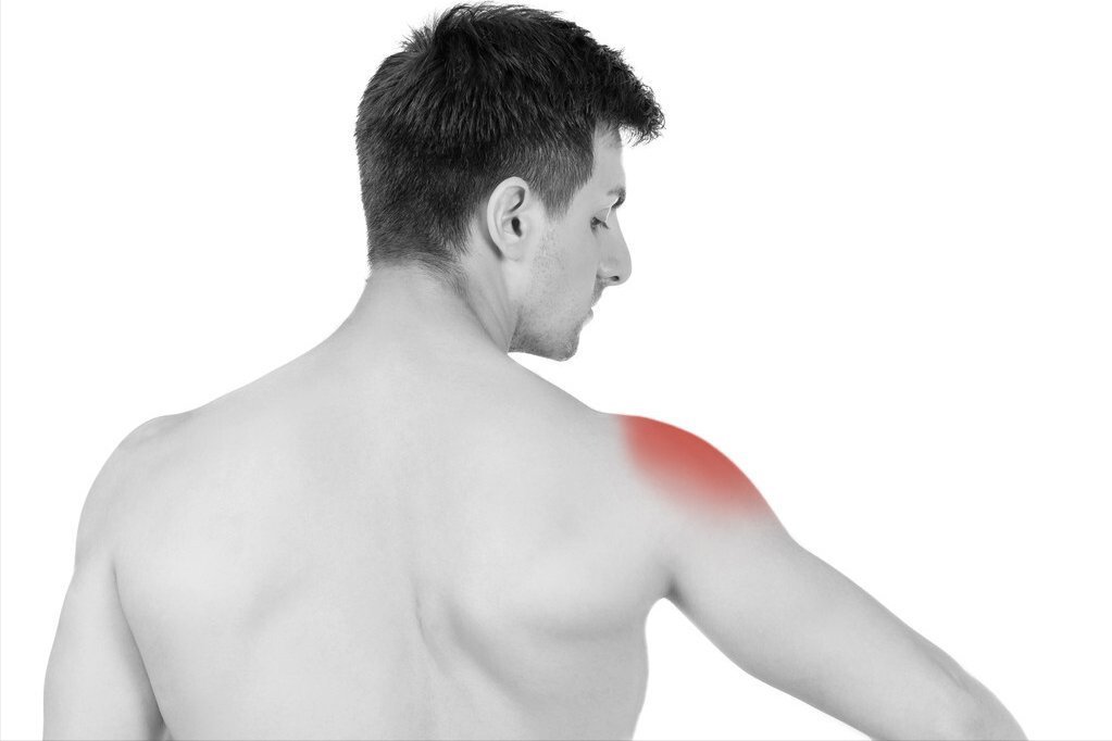 钙化性肌腱炎|长在肩膀上的“结石”:6旬阿姨肩膀半夜痛醒误以为肩周炎,原来是肩袖钙化性肌腱炎