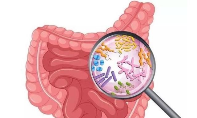 便血|52岁男子深夜腹痛送医查出肠癌，医生：肠癌从发生到晚期只4步