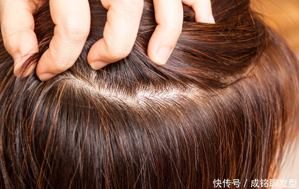 头发染什么颜色,过敏风险最小?做好皮肤测试,才能放心染发