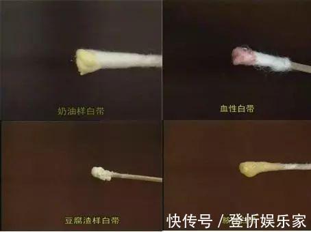 萌萌|28岁女子，经血不断，查出宫颈癌，与“高危丈夫”，脱不了干系