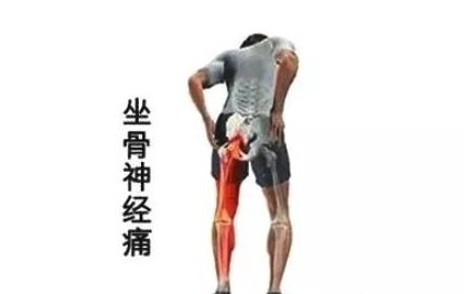 小偏方|一个简单小偏方,太神奇!腰间盘突出折腾很长时间,现在终于痊愈