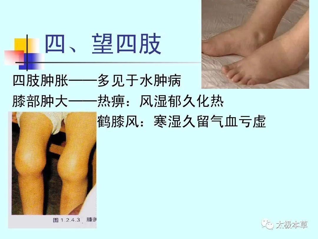 调匀|手脚出现的小毛病,用简易良方,原料易得,收藏吧·