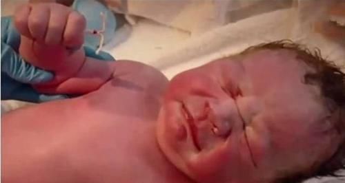 怀孕|新生宝宝“顺手牵环”,手握避孕环霸气出生,网友:此娃必成大器