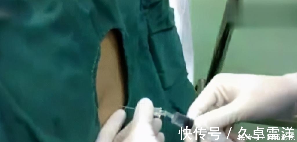 脊柱|剖腹产就是睡一觉那么简单?看看手术用的工具,就知啥叫为母则刚