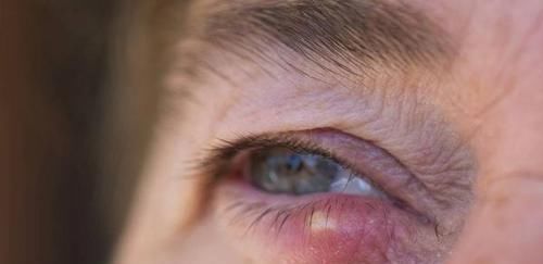 男人到了中年,这5个检查不能“省”,越早检查越好