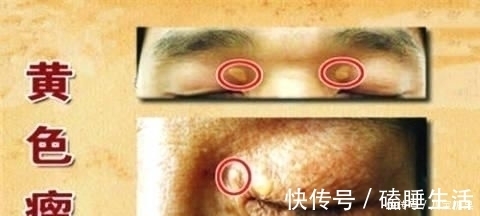 黄酮类化合物|中医院士1个食疗方,开水里放1物,血管干净、高血脂降了