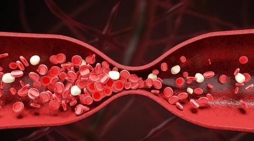 药材|高血脂的“天敌”被发现,经常泡水喝,坚持1月,甘油三酯不见了