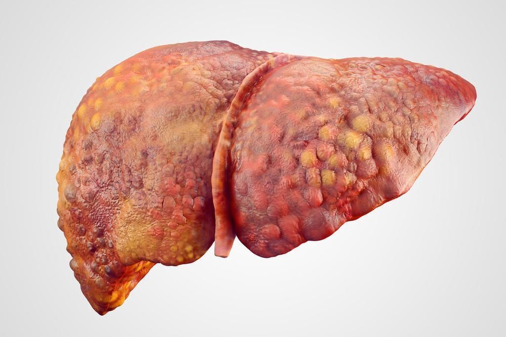 研究|90岁院士,研究肝病40年,提醒:多吃“一物”,养肝更护肝