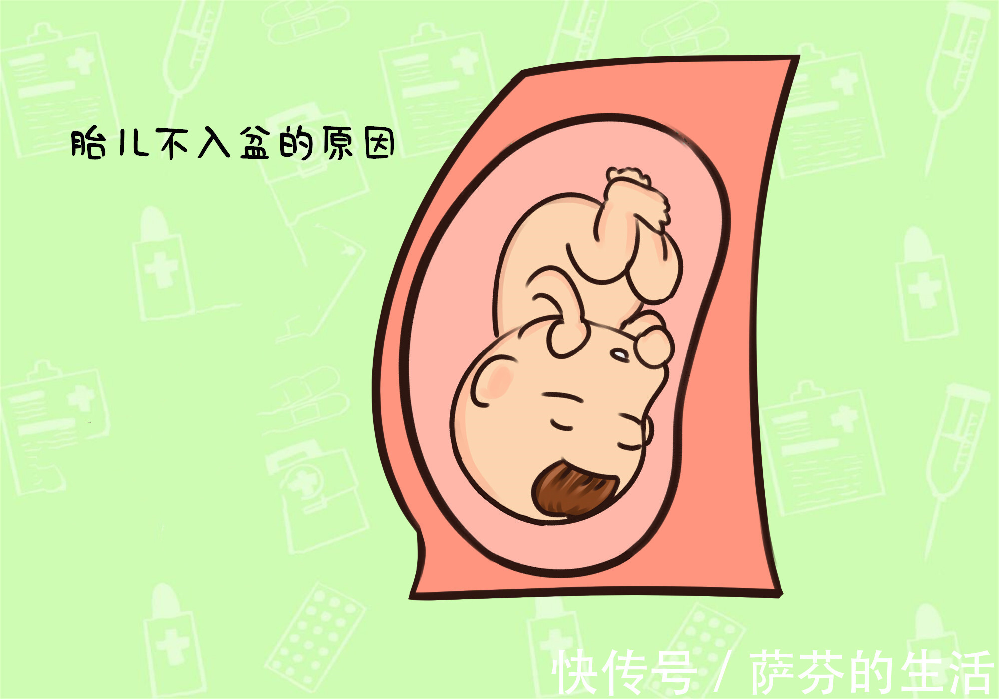 入盆|胎儿“入盆”有何感觉最后的“煎熬阶段”挺难受的,痛并快乐着