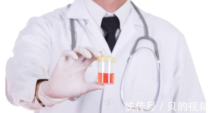 肿瘤病毒|这4个症状，超过3个宫颈癌已不是早期，做好1件事，宫颈癌走远远