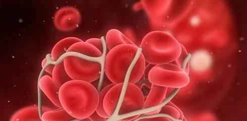 这东西被丢在厨房角落,却是“天然阿司匹林”,常吃让血栓靠边站