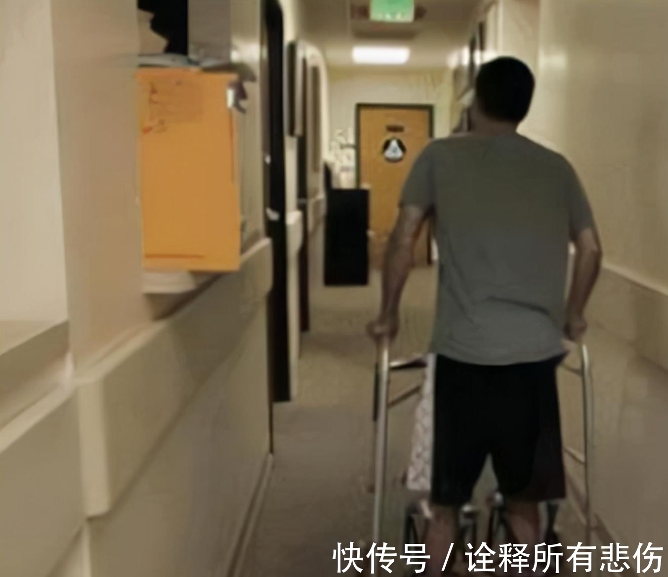 骨增高术|7年前,李亚诺花16万锯断骨头,只为长高7厘米,手术后怎样了?