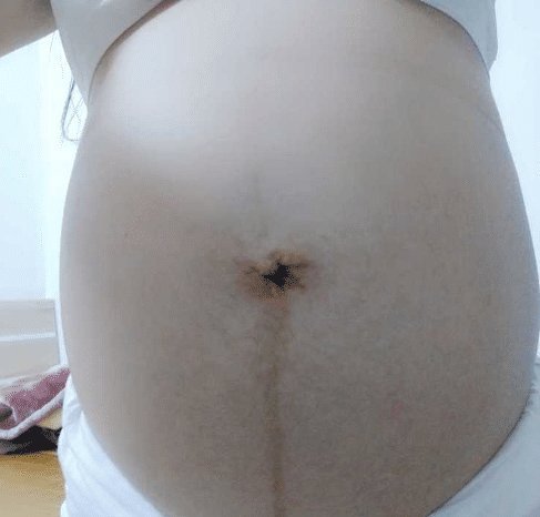 胎梦|“孕16周梦见蛇了,是什么影响”孕期胎梦暗示什么