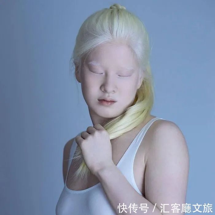 逆袭|因“全身雪白”被遗弃的中国女孩，逆袭成超模的故事让人泪目