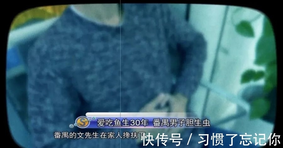 瓜子|头皮发麻！男子体内惊现大量“瓜子”活虫……取出来还在动！