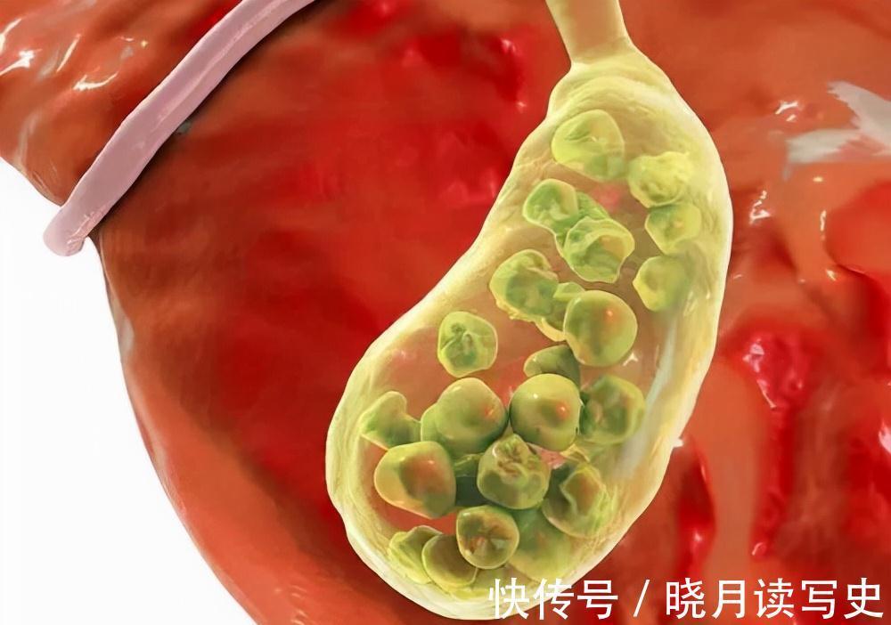 薏米粥|早上起床后,宁愿饿肚子,也尽量要少碰4类早餐,尽早转告家人