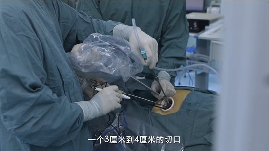 免疫治疗|肺癌早发现早治疗 新“武器”不断出现