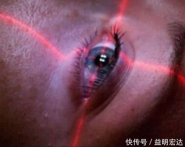 蹦极|近视600度以上,这3件事要早戒,当心导致“视网膜脱落”