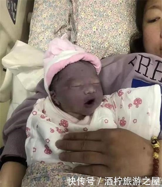 惊喜|刚出生的女儿好像蓝莓成精,妈妈看后直接哭了,3个月后收获惊喜