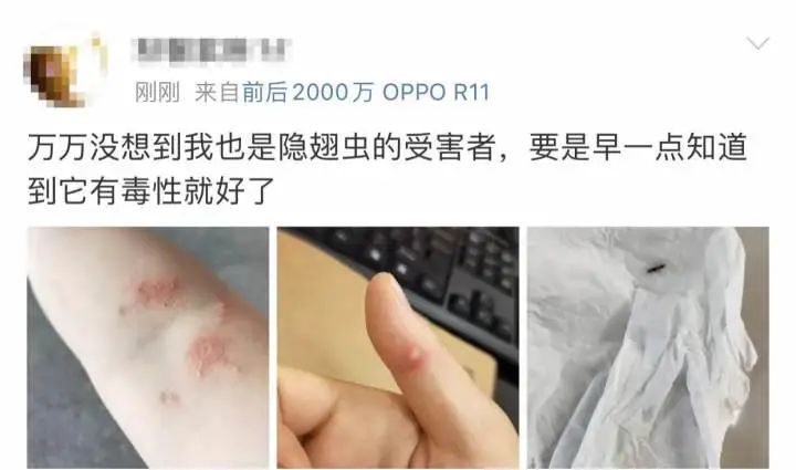 毁容|又是它!女子半夜关灯玩手机,差点致毁容!