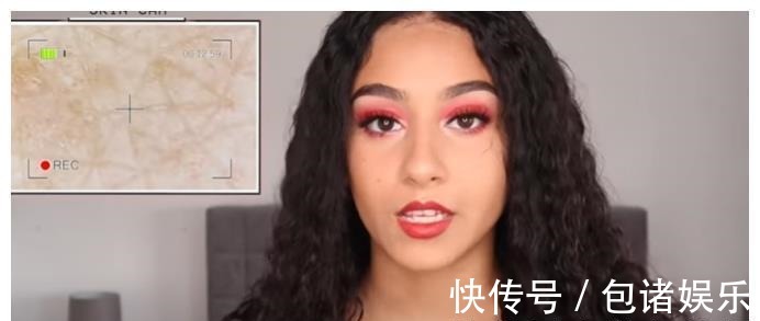 过敏|英国23岁女孩患“水过敏”,洗澡堪比酷刑,全球患者不超过100人