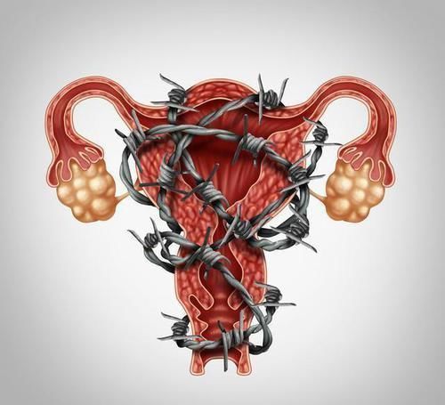 诊治|子宫健康，上厕所时没有4个表现，常做3事，吃2物，让身体更健康