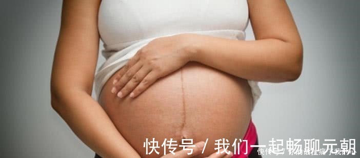 白线|原来孕妈肚子上的“黑线”,透露这些秘密!