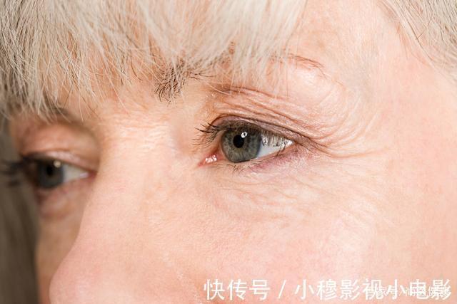 肝癌|身体两处“发痒”,别误以为是过敏了,或是肝癌的征兆,需警惕