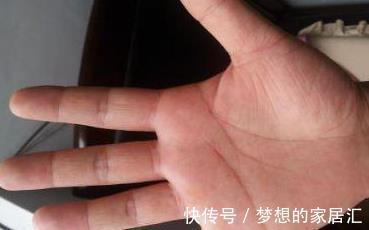 指甲|一个肝脏好的人手上没有三个表现,如果你也没有,恭喜你了!
