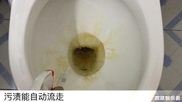 白醋|小苏打加白醋里太厉害了,好多人的难题全都解决了,看完抓紧试试