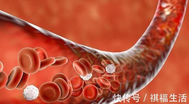 垃圾|4种“碱性食物”经常吃，排出体内毒素，给血管“洗个澡”！