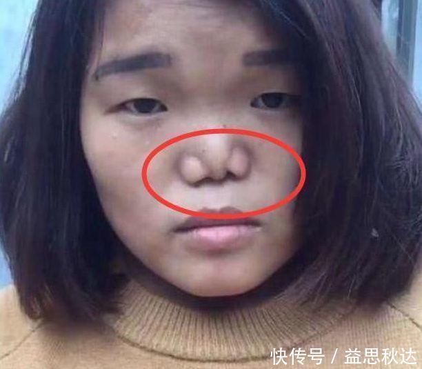 鼻子|青春期女生“贼伤鼻子”的3行为,自认为很舒服,难怪异性缘为0