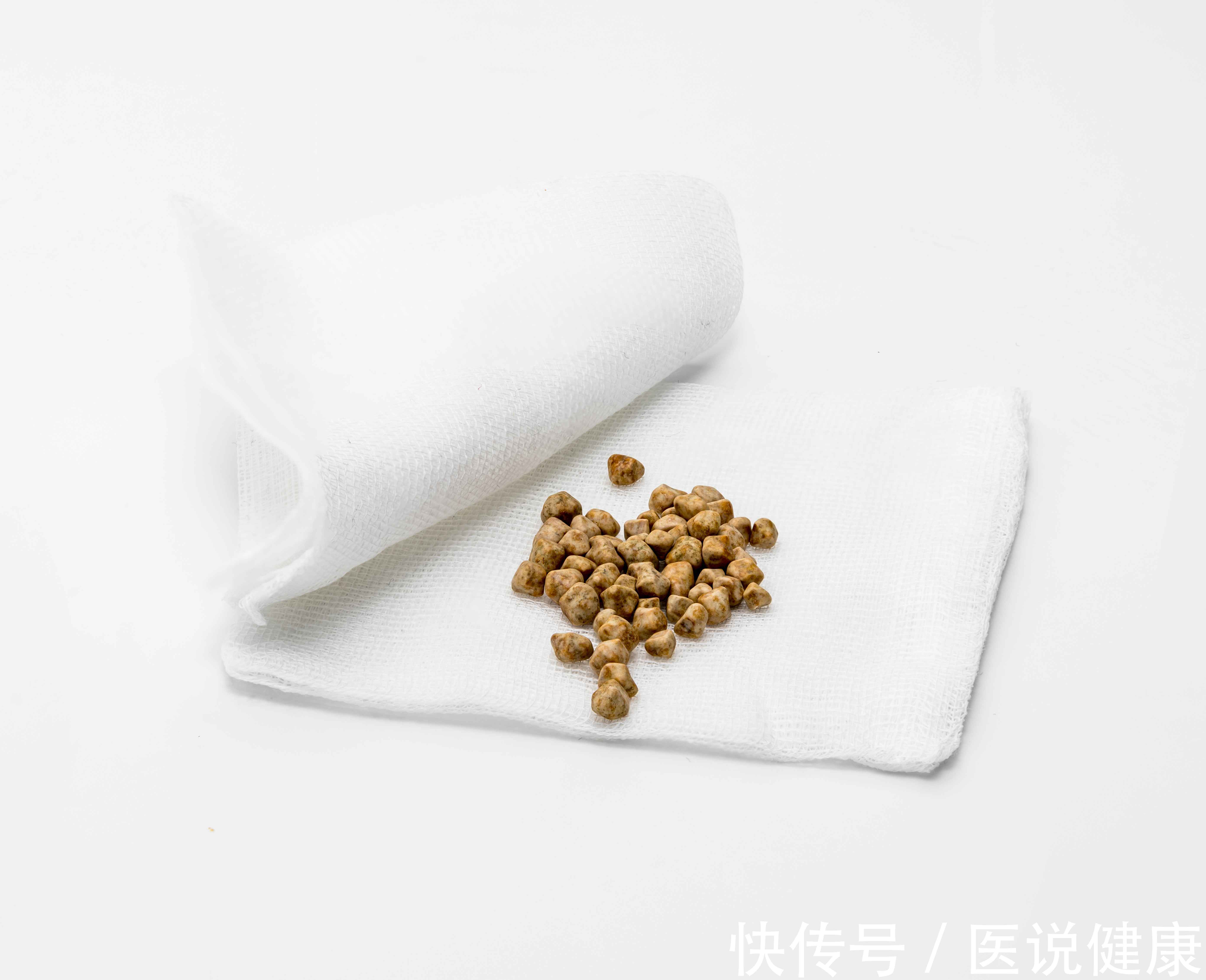 鸡蛋|一天吃4个鸡蛋,却吃出了胆结石?这则新闻实属太随便“扣帽子”