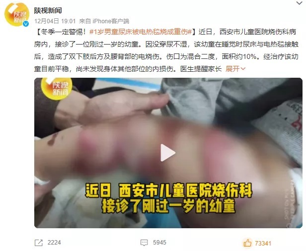 婴儿猝死症|1岁男童尿床被严重烧伤,冬季取暖,当心“神器”变“凶器”!