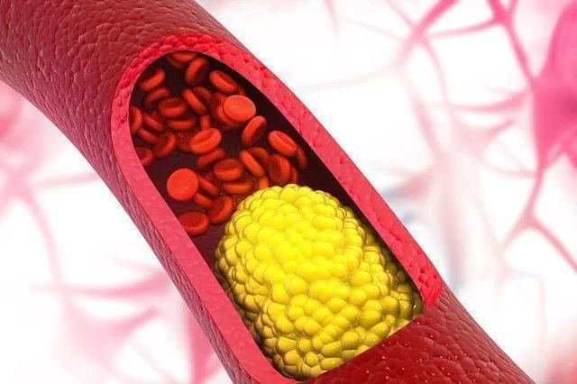 脂肪含量|高血脂的人能吃玉米吗?血脂偏高的人,这几种食物应尽量少吃