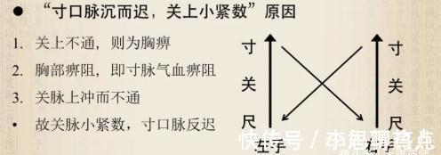 心脏病|医圣张仲景:一个治心脏病的千古名方,横扫冠心病、心绞痛、心梗