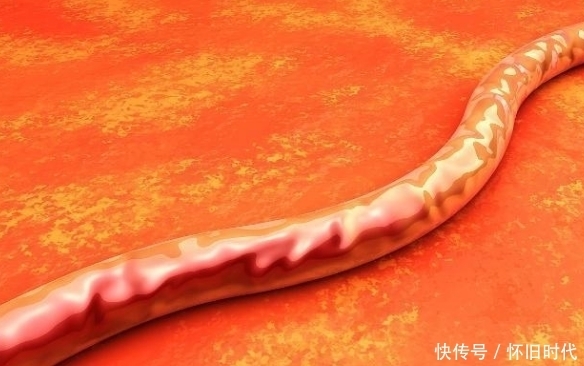 【草丁图书馆】45-55岁是生命的“高危期”,最怕3处变硬,3件事可助你安稳