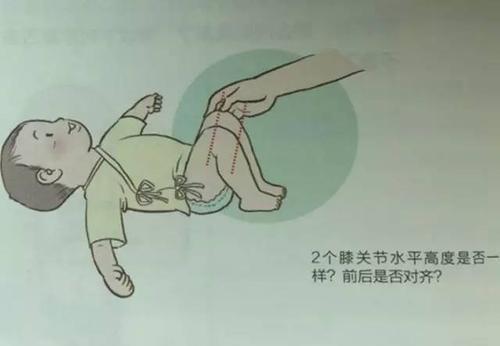 宝宝皮纹不对称是正常的吗